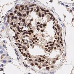 Histone H3, p Ser10 Antibody, Novus Biologicals 0.025mg; Unlabeled:Antibodies,